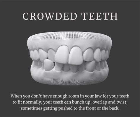 Studio Dental - Best Dental Hospital in Hyderabad - Dental Clinic ...