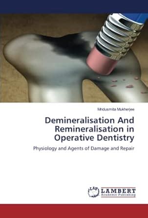 Demineralisation And Remineralisation in Operative Dentistry : Amazon ...