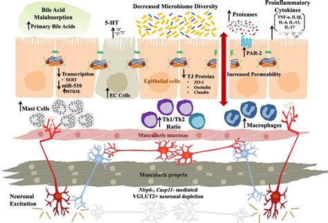 Post-infection Irritable Bowel Syndrome - PMC