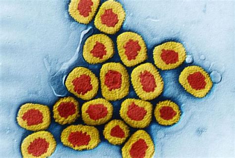 感染轮状病毒会出现哪些症状 轮状病毒会引发什么疾病 _八宝网