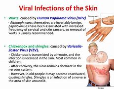 Image result for Infectious Skin Diseases