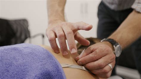 How Does Dry Needling Work?: Chiropractic Plus : Chiropractic Plus