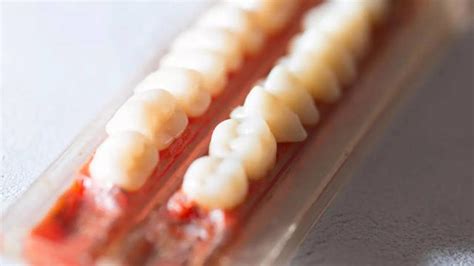 Scientists grow human teeth in a lab, and it may change dentistry forever