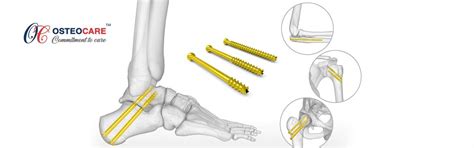SHRISHRIJI MEDISYS PVT LTD Orthopaedic Cast Padding Manufacturers in ...