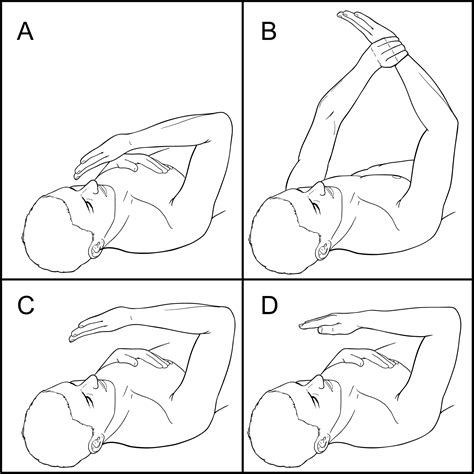Elbow Dislocation - Raleigh Hand Surgery — Joseph J. Schreiber, MD