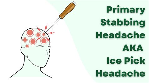 Primary Stabbing Headache aka Ice Pick Headache (symptoms, pathophysio ...