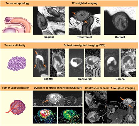 Image result for Classification of Machine and Deep Learning Model