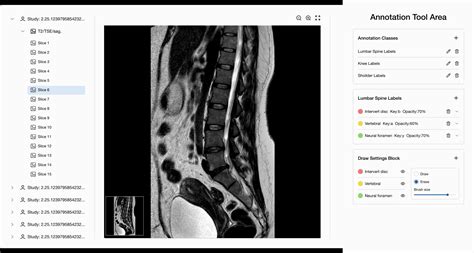 Image result for MRI Software Tutorial