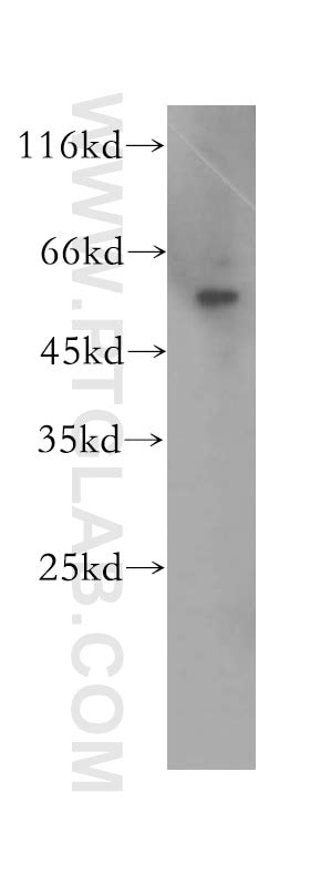 SDSL antibody (16242-1-AP) | Proteintech