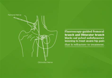 Hip, Knee and Ankle Pain Relief | Atlas Pain Care