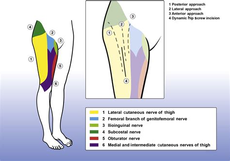 Fascia iliaca compartment block - BJA Education