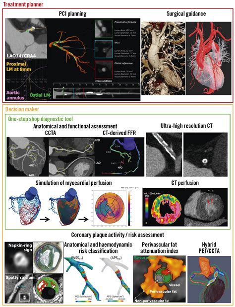 Computed tomographic angiography in coronary artery disease ...