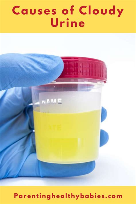 What Does Cloudy Urine Mean During Pregnancy at Donald Blanton blog