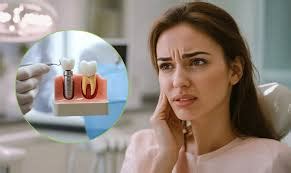 Dental Veneers in Hyderabad - Transform Your Smile at Dermadent Dental ...