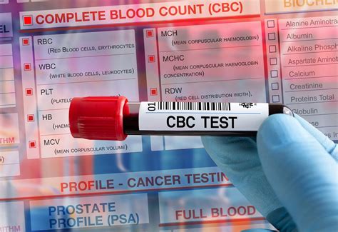 How Much Does An STD Test Cost With Insurance? | LiveWell