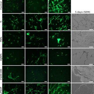 Image result for Scale Bar Microscope