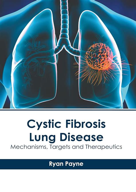 Buy Cystic Fibrosis Lung Disease: Mechanisms, Targets and Therapeutics ...
