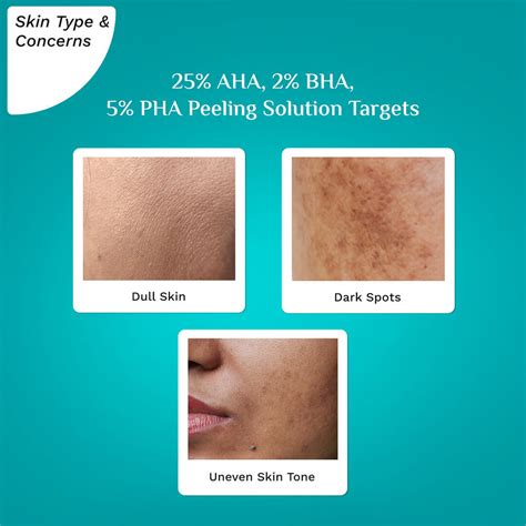 Buy 25% AHA, 2% BHA, 5% PHA Peeling Solution For Tan Removal