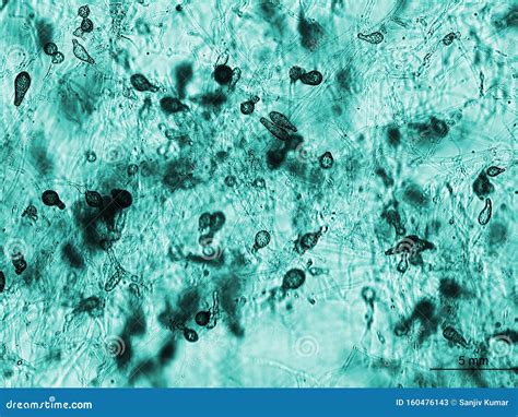 Fungus Like Growth Under the Microscope Stock Image - Image of oomycetes, growing: 160476143