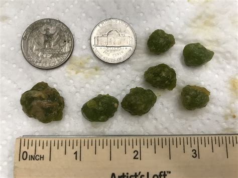 Gallbladder Stones – Herbal Education Center