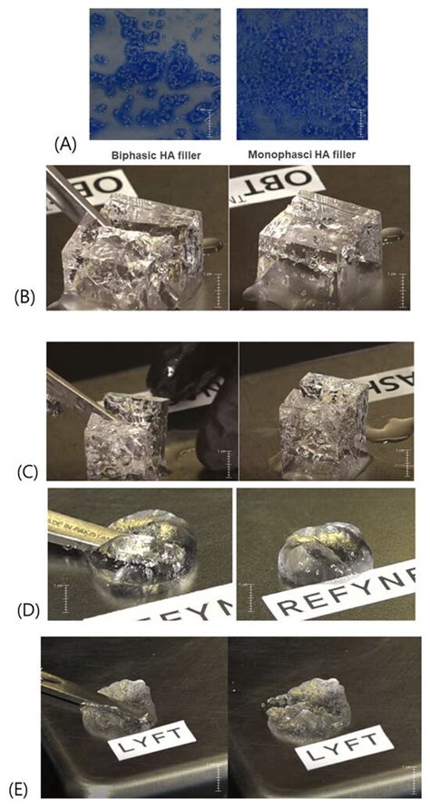 Rheological Characteristics of Hyaluronic Acid Fillers as Viscoelastic ...