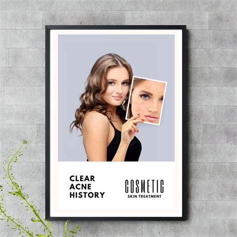 Cosmetic Clear Acne Skin Treatment Poster Without Frame : Amazon.in: Beauty