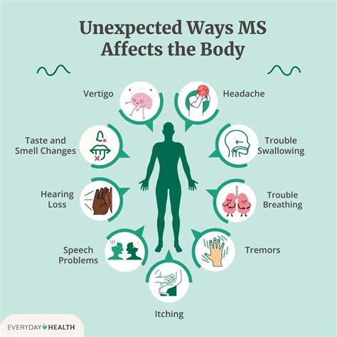 15 Symptoms Of Multiple Sclerosis Ms In Women