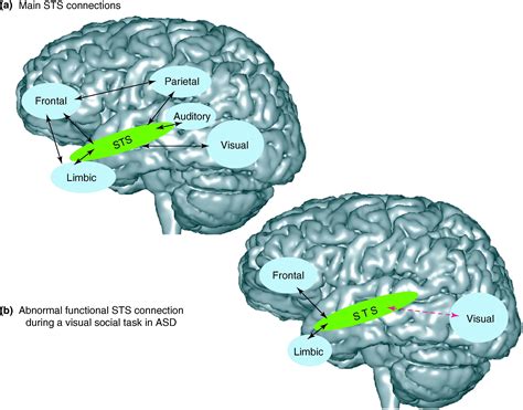 Superior Temporal Sulcus