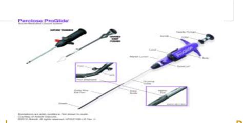 Image result for Perclose Device Tutorial