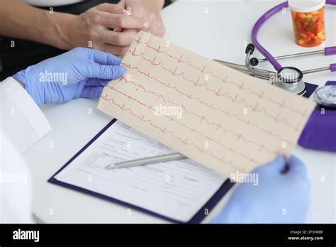 Cardiogram Procedure 的图像结果