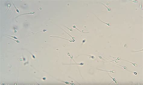 How To Check Sperm Under Microscope - Birthdaypost10