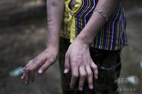 子どもに対する性的虐待件数、今年は前年比4割増 ミャンマー 写真1枚 国際ニュース：AFPBB News
