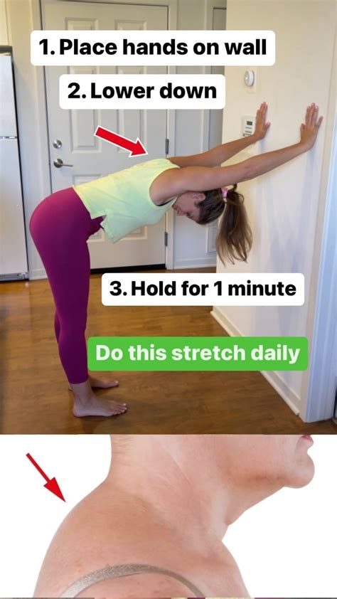 Dowager’s hump 101 7 neck hump exercises that help – Artofit