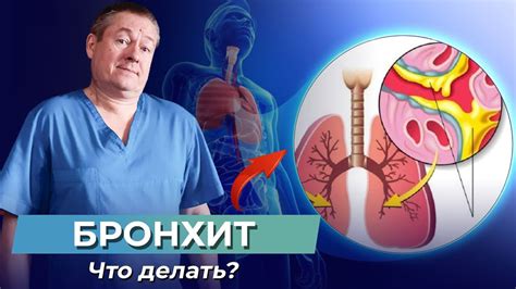 Как вылечить бронхит правильно и быстро