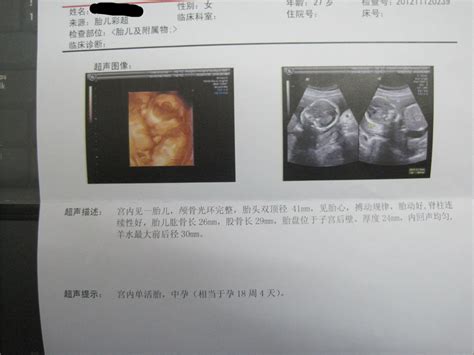 婴儿出生双顶径多大（孕19周的胎儿）-幼儿百科-魔术铺