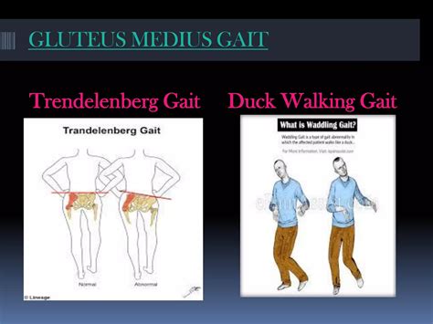 Image result for Contralateral Gait
