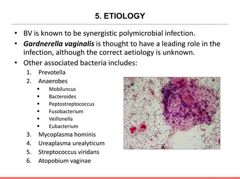 Bacterial Vaginosis.pptx