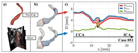 Comparison of Manual versus Semi-Automatic Segmentations of the ...