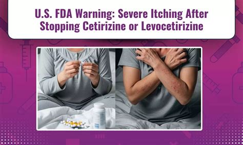 U.S. FDA Drug Safety Alert: Warning Issued for Severe Itching After ...