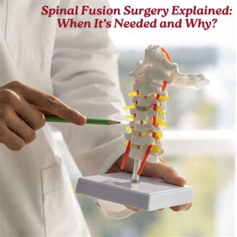 Spinal Fusion Surgery Explained: When It’s Needed and Why? | Spine and Neuro Surgery Hospital ...