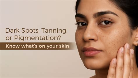 Pigmentation vs. Dark Spots vs. Tanning: Key Differences & Best ...