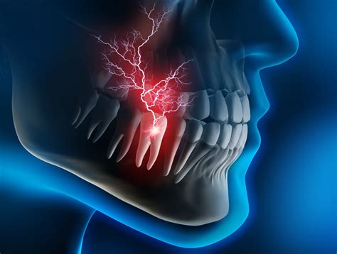 Different Types of Tooth Pain and What They Mean