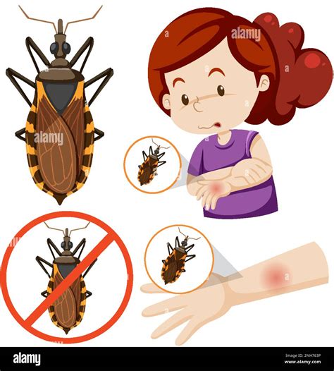 Human arm swollen from kissing bug bite illustration Stock Vector Image & Art - Alamy