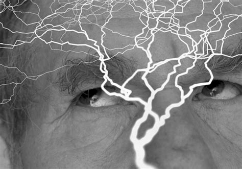 Sensibilisierung von Epilepsie: Tagung im Kurhaus - UnserTirol24