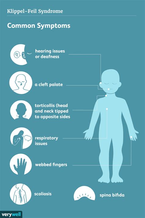 What Is Klippel-Feil Syndrome?
