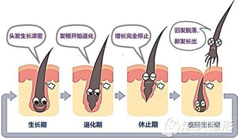 大家都关心头发移植价钱，我却想知3000毛囊单位种完是多少根 - 脱发治疗 - 炫美网