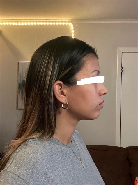 Best Nursing Position For Recessed Chin at Glenn Ledoux blog