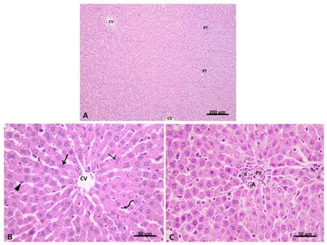 Hepatoprotective Role of Carvedilol against Ischemic Hepatitis ...