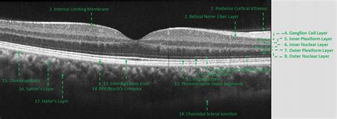 Heidelberg Spectralis OCT - Burnett Hodd & Tam Optometry