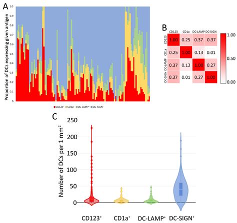 Dendritic Cell Subpopulations Are Associated with Prognostic ...